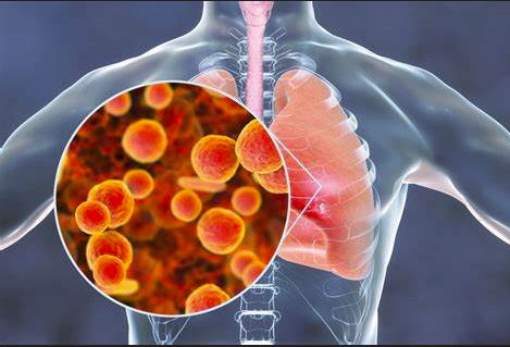 Mycoplasma pneumoniae 1.jpg